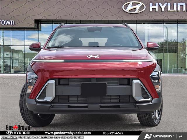 2026 Hyundai Kona 2.0L Preferred (Stk: U389779) in Brooklin - Image 2 of 26
