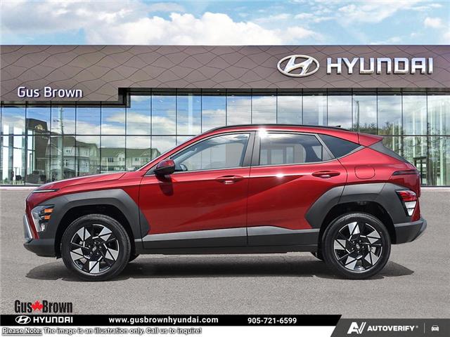 2026 Hyundai Kona 2.0L Preferred (Stk: U389779) in Brooklin - Image 3 of 26