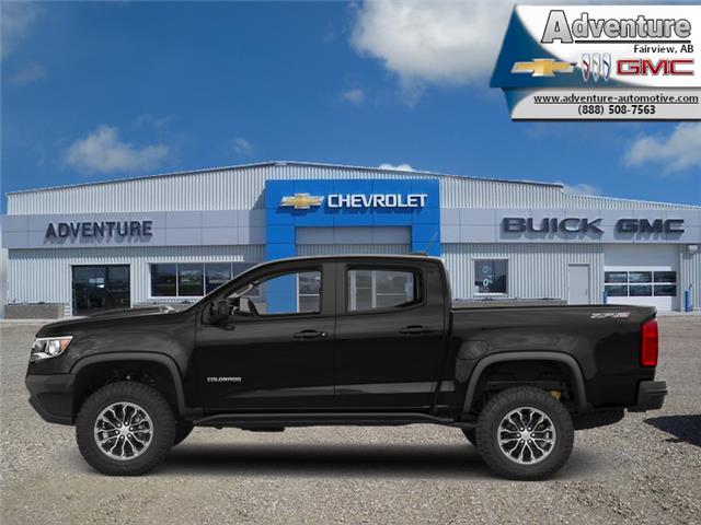 2017 Chevrolet Colorado ZR2 (Stk: 45095A) in Fairview - Image 1 of 1