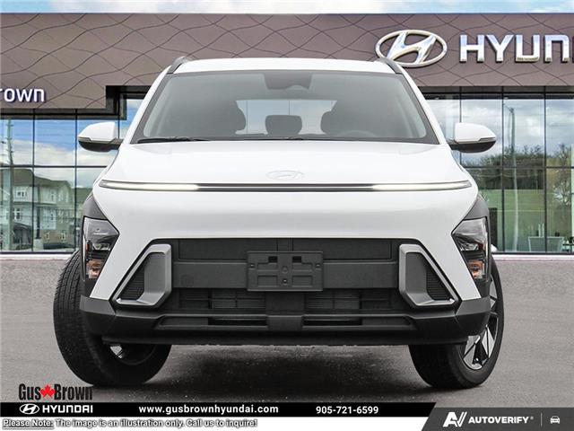 2026 Hyundai Kona 2.0L Preferred (Stk: U354532) in Brooklin - Image 2 of 26