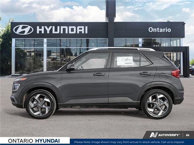 2025 Hyundai Venue Ultimate w/Black Interior (IVT) (Stk: ONH349028) in Whitby - Image 3 of 21