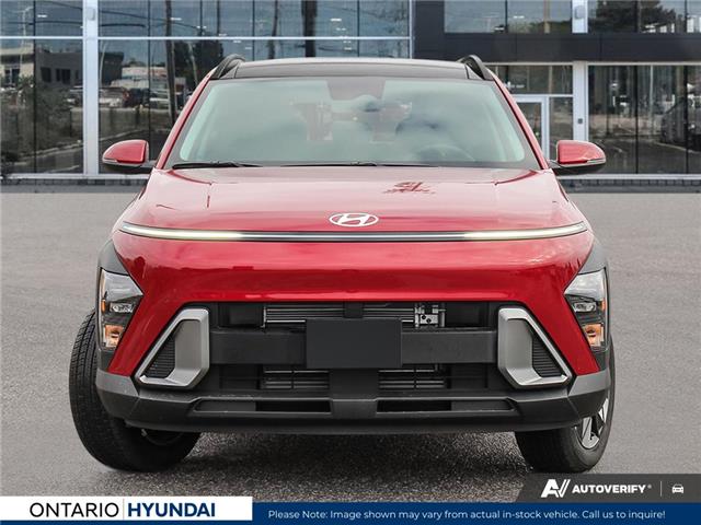 2025 Hyundai Kona 1.6T Preferred Sport (Stk: 7-1049) in Whitby - Image 2 of 25