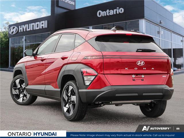 2025 Hyundai Kona 1.6T Preferred Sport (Stk: 7-1049) in Whitby - Image 4 of 25