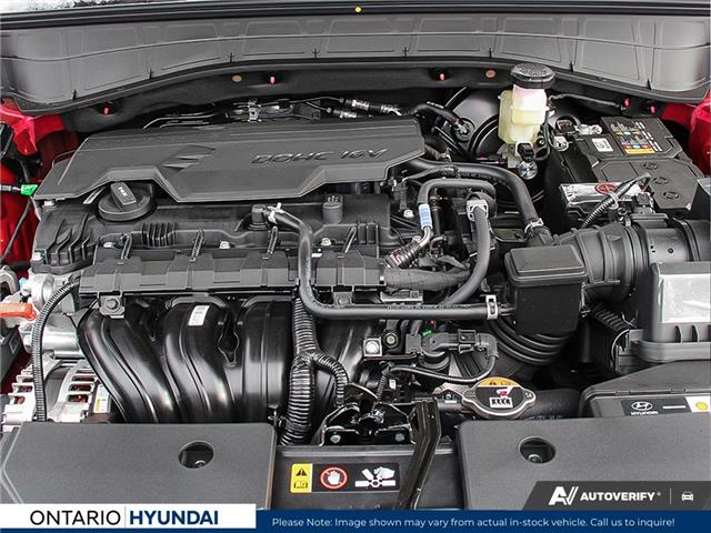 2025 Hyundai Kona 1.6T Preferred Sport (Stk: 7-1049) in Whitby - Image 6 of 25
