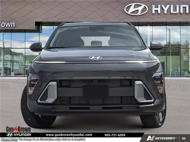 2026 Hyundai Kona 2.0L Preferred (Stk: U389474) in Brooklin - Image 2 of 26