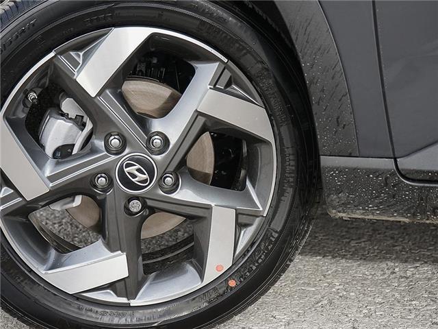 2026 Hyundai Venue Ultimate w/Black Interior (IVT) (Stk: 261832) in Aurora - Image 7 of 21