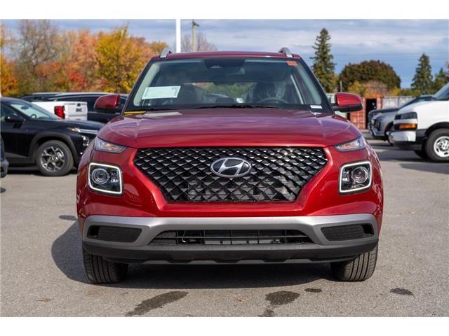 2026 Hyundai Venue Preferred w/Two-Tone (Stk: S26156) in Ottawa - Image 6 of 21