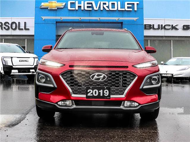 2019 Hyundai Kona 1.6T Ultimate (Stk: 26064A) in Ingersoll - Image 2 of 27