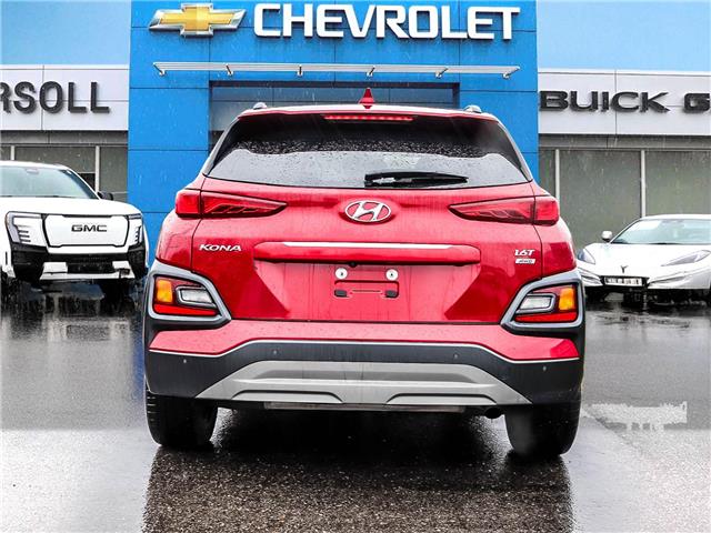 2019 Hyundai Kona 1.6T Ultimate (Stk: 26064A) in Ingersoll - Image 4 of 27