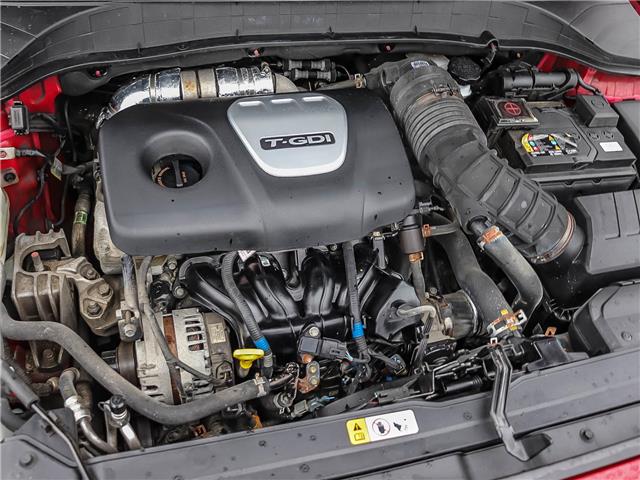 2019 Hyundai Kona 1.6T Ultimate (Stk: 26064A) in Ingersoll - Image 27 of 27