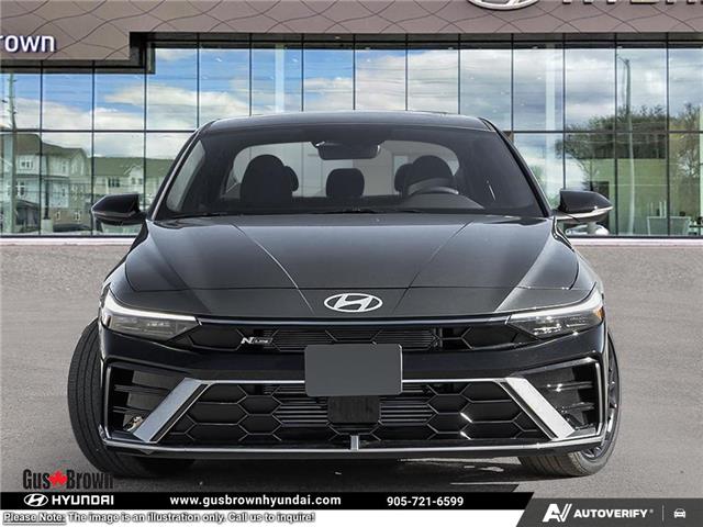 2026 Hyundai Elantra N-Line Ultimate (Stk: U097681) in Brooklin - Image 2 of 25