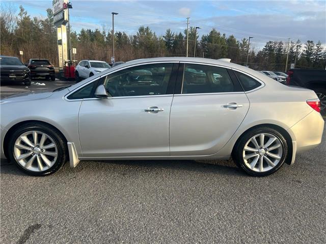 2017 Buick Verano Leather (Stk: 250697A) in Ottawa - Image 2 of 26