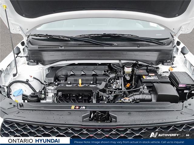 2026 Hyundai Venue Ultimate w/Black Interior (IVT) (Stk: 7-1497) in Whitby - Image 6 of 24