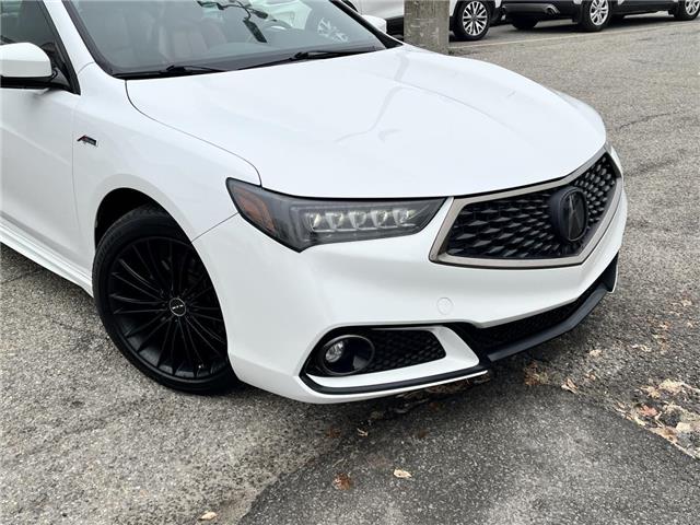 2020 Acura TLX (Stk: DZ1196A) in Ottawa - Image 3 of 16 2020 Acura TLX (Stk: DZ1196A) in Ottawa - Image 3 of 16