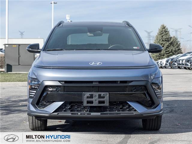 2024 Hyundai Kona 1.6T N Line w/Two-Tone Roof (Stk: 139227) in Milton - Image 2 of 26