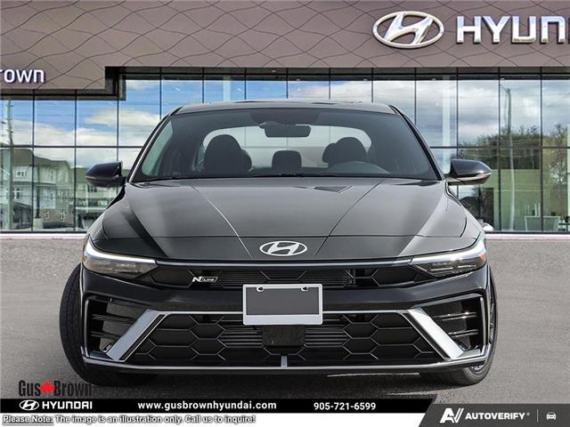 2026 Hyundai Elantra N-Line Ultimate (Stk: U097906) in Brooklin - Image 2 of 23
