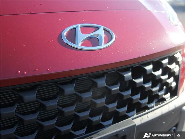 2022 Hyundai Kona 2.0L Preferred Sun & Leather Package (Stk: 131882) in London - Image 8 of 25 2022 Hyundai Kona 2.0L Preferred Sun & Leather Package (Stk: 131882) in London - Image 8 of 25