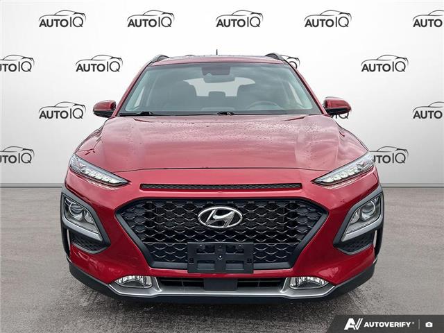 2020 Hyundai Kona 2.0L Luxury (Stk: R532A) in Grimsby - Image 2 of 24