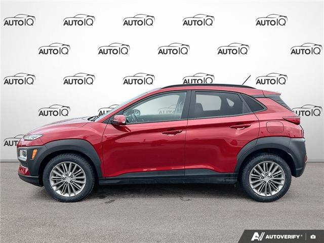 2020 Hyundai Kona 2.0L Luxury (Stk: R532A) in Grimsby - Image 3 of 24