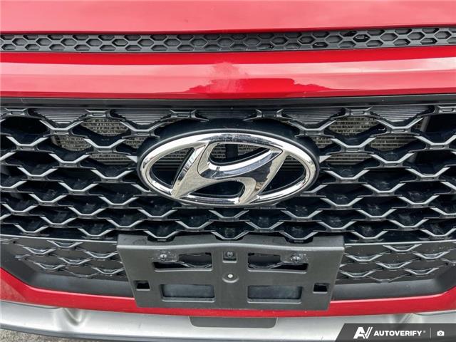 2020 Hyundai Kona 2.0L Luxury (Stk: R532A) in Grimsby - Image 9 of 24