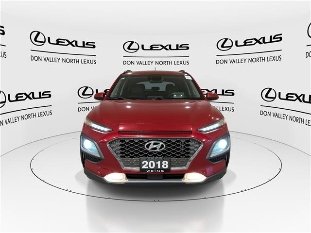 2018 Hyundai Kona  (Stk: 14U7079) in Markham - Image 4 of 32