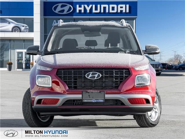 2026 Hyundai Venue Preferred w/Two-Tone (Stk: 434811) in Milton - Image 2 of 24