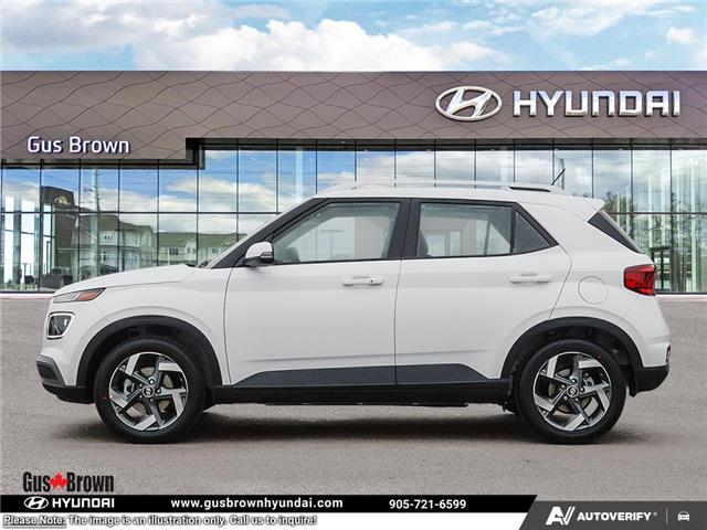 2026 Hyundai Venue Ultimate w/Black Interior (IVT) (Stk: U436410) in Brooklin - Image 3 of 24
