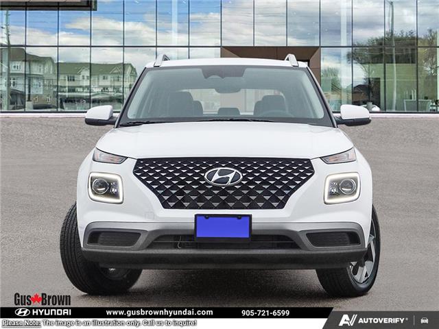 2026 Hyundai Venue Ultimate w/Black Interior (IVT) (Stk: U436404) in Brooklin - Image 2 of 24
