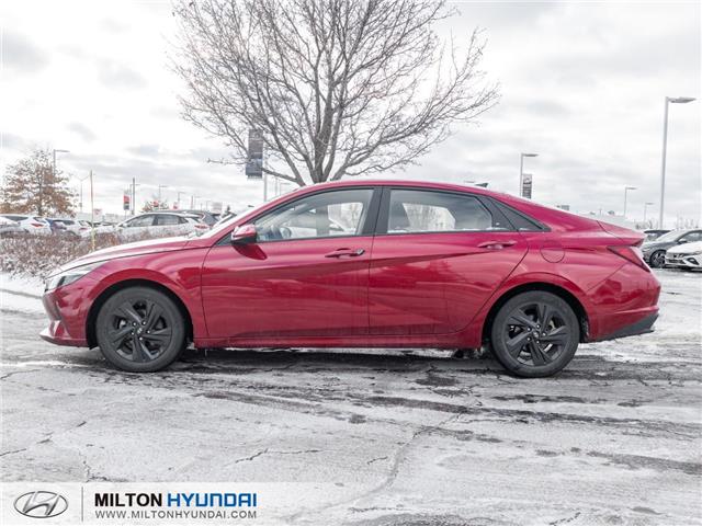 2021 Hyundai Elantra Preferred (Stk: 104379) in Milton - Image 3 of 23