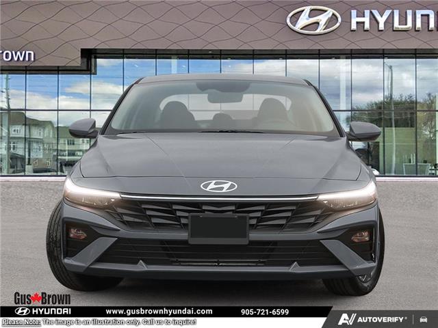2026 Hyundai Elantra Preferred (Stk: U129311) in Brooklin - Image 2 of 23