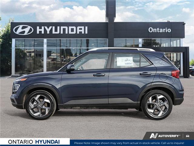2026 Hyundai Venue Ultimate w/Denim Interior (IVT) (Stk: 7-1548) in Whitby - Image 3 of 24