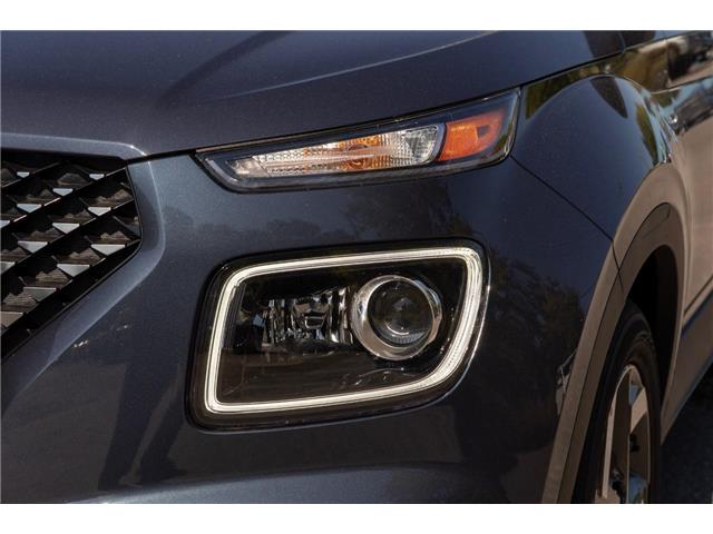 2026 Hyundai Venue Ultimate w/Denim Interior (IVT) (Stk: S26277) in Ottawa - Image 4 of 22