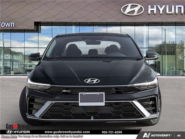 2026 Hyundai Elantra N-Line Ultimate (Stk: U125538) in Brooklin - Image 2 of 23