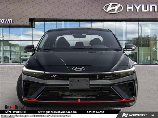 2026 Hyundai Elantra N Base (Stk: U037945) in Brooklin - Image 2 of 22