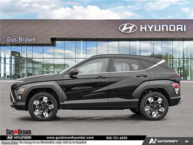 2026 Hyundai Kona 2.0L Preferred w/Trend Package (Stk: U412283) in Brooklin - Image 3 of 25