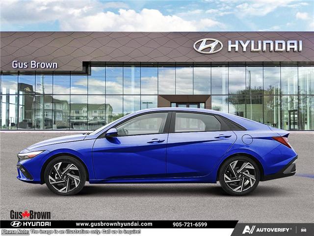 2026 Hyundai Elantra Preferred (Stk: U127293) in Brooklin - Image 3 of 25