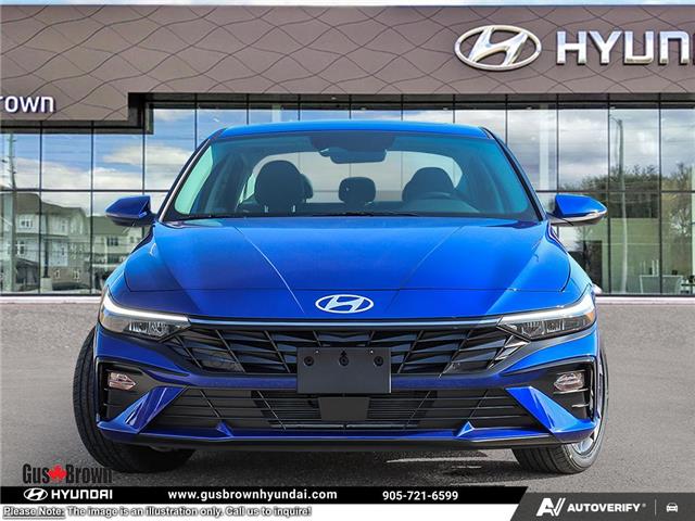 2026 Hyundai Elantra HEV Luxury (Stk: U190027) in Brooklin - Image 2 of 24
