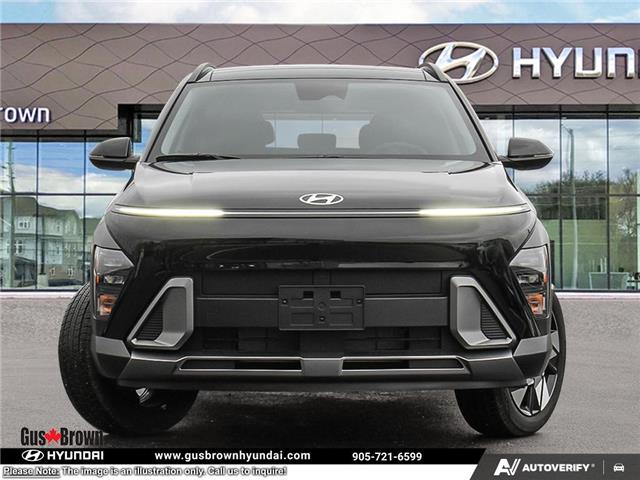 2026 Hyundai Kona 2.0L Preferred w/Trend Package (Stk: U412323) in Brooklin - Image 2 of 25