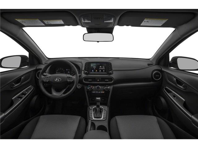 2019 Hyundai Kona 2.0L Luxury (Stk: 35475A) in Scarborough - Image 5 of 11