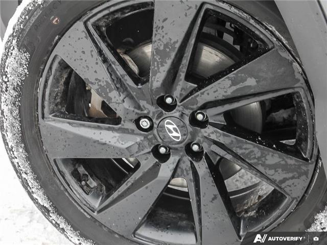 2023 Hyundai Santa Cruz Ultimate (Stk: 111096) in London - Image 6 of 25