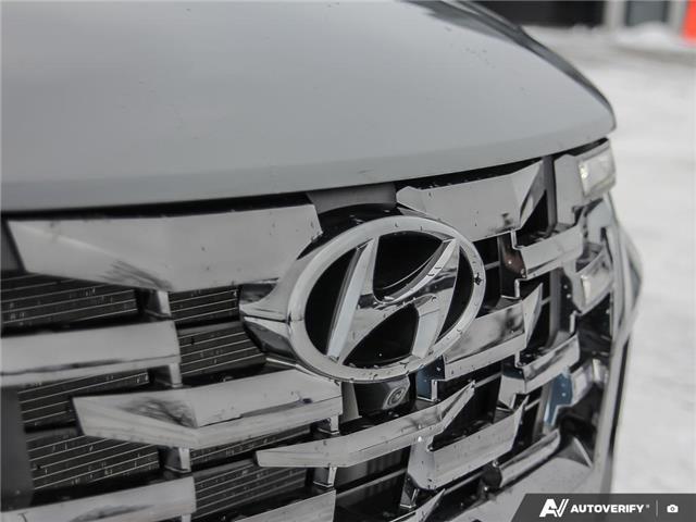 2023 Hyundai Santa Cruz Ultimate (Stk: 111096) in London - Image 8 of 25