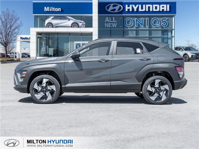 2025 Hyundai Kona 1.6T Preferred Sport (Stk: 308129) in Milton - Image 3 of 26 2025 Hyundai Kona 1.6T Preferred Sport (Stk: 308129) in Milton - Image 3 of 26
