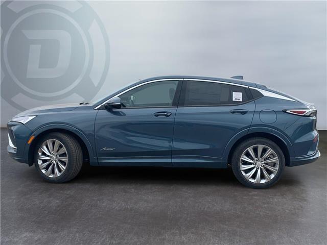 2025 Buick Envista Avenir (Stk: 265223) in Brooks - Image 2 of 15
