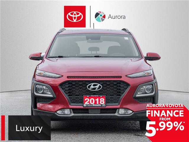 2018 Hyundai Kona 2.0L Luxury (Stk: 360342) in Aurora - Image 2 of 25