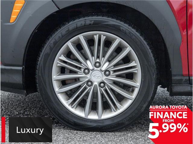 2018 Hyundai Kona 2.0L Luxury (Stk: 360342) in Aurora - Image 5 of 25