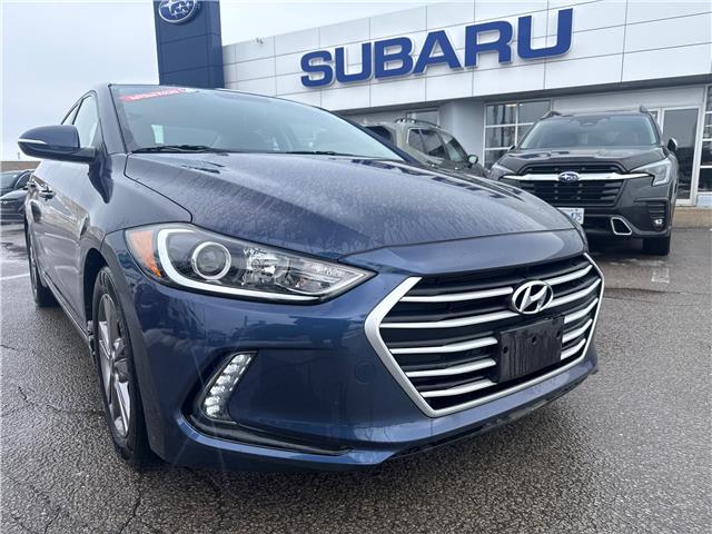 2017 Hyundai Elantra GLS (Stk: S26101A) in Newmarket - Image 2 of 17 2017 Hyundai Elantra GLS (Stk: S26101A) in Newmarket - Image 2 of 17