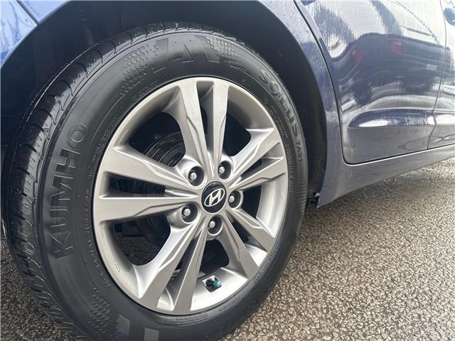 2017 Hyundai Elantra GLS (Stk: S26101A) in Newmarket - Image 8 of 17 2017 Hyundai Elantra GLS (Stk: S26101A) in Newmarket - Image 8 of 17