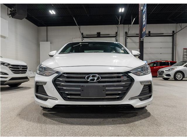 2018 Hyundai Elantra Sport Tech (Stk: RE68639) in Calgary - Image 2 of 25
