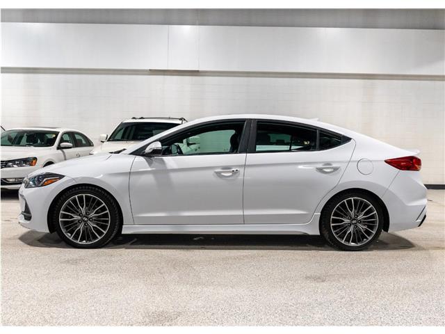 2018 Hyundai Elantra Sport Tech (Stk: RE68639) in Calgary - Image 7 of 25