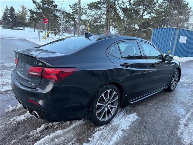 2020 Acura TLX Elite A-Spec (Stk: 45559A) in Newmarket - Image 5 of 32